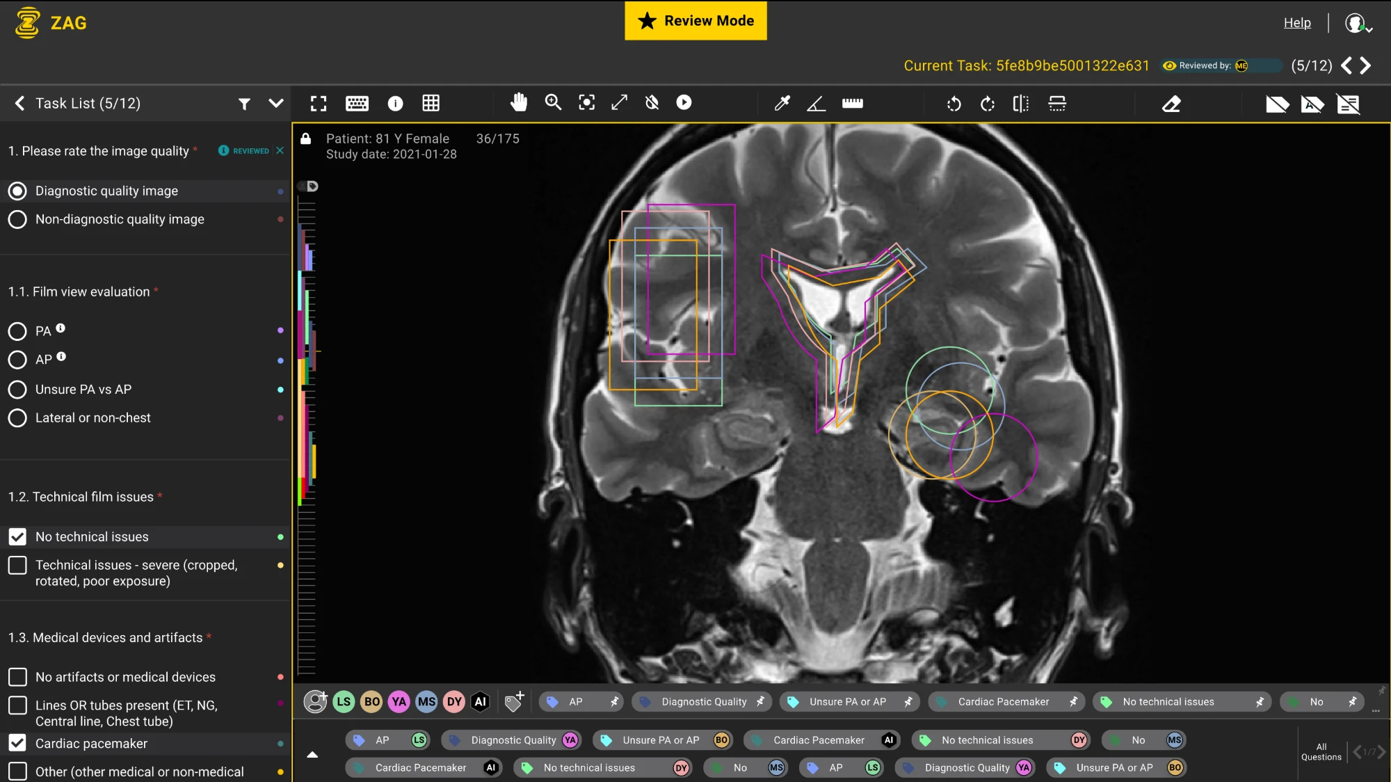 Medical imaging review tool: a brain MRI with overlapping annotations from several readers and the AI, a reading questionnaire and per-reader label chips